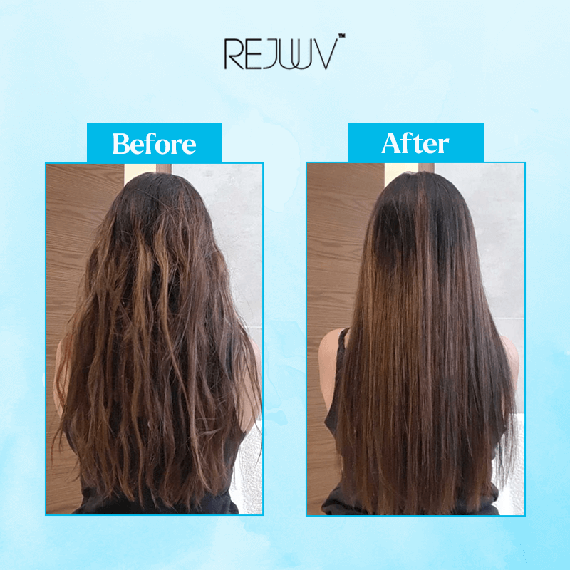 Hair Restoration Filler