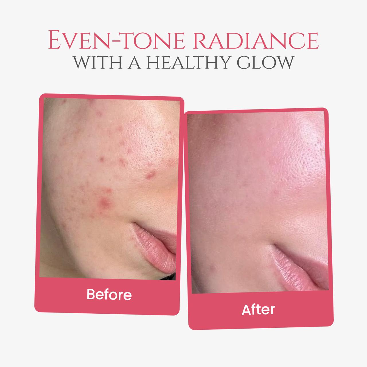 Salmon PDRN Pink Collagen Capsule Cream